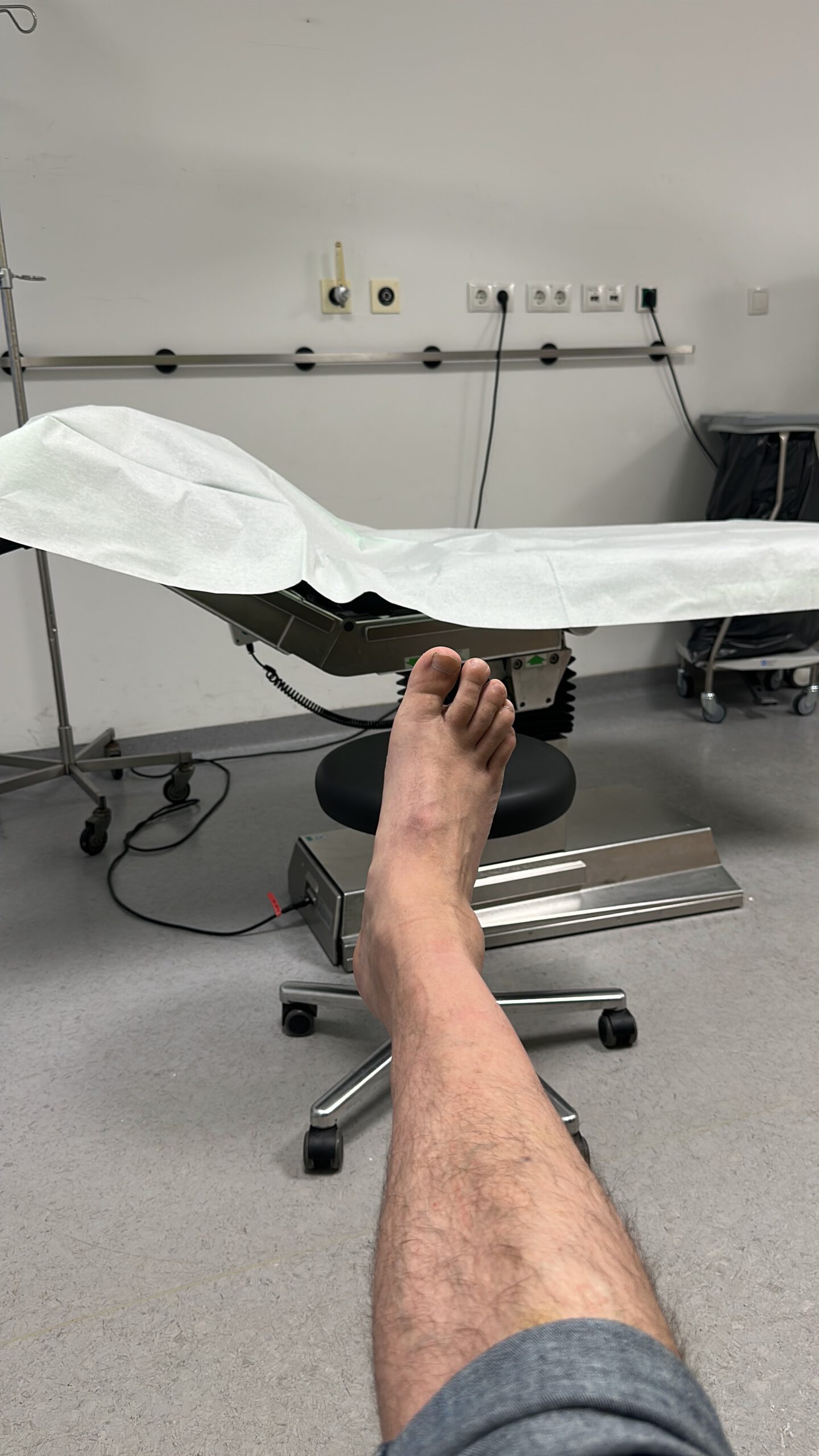 Ein verletzter rechter Fuß liegt ausgestreckt in einem Untersuchungsraum der Notaufnahme, im Hintergrund eine medizinische Liege.